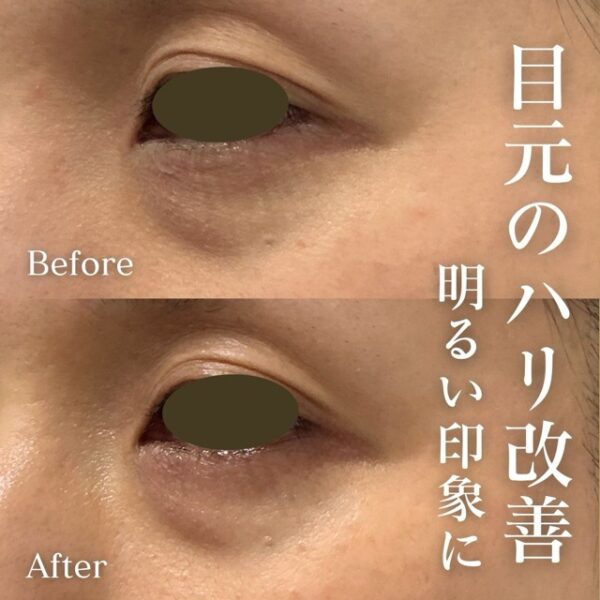 No.21222の症例写真くま集中ケア　3回