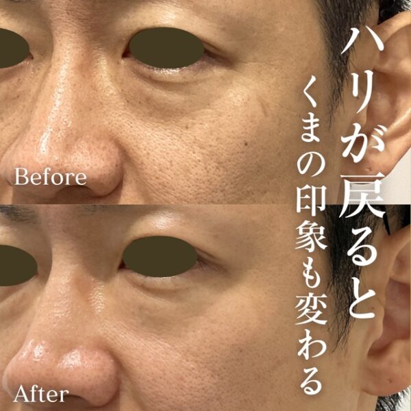 No.21215の症例写真くま集中ケア　3回