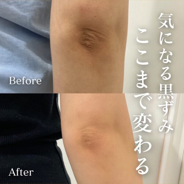 No.21794の症例写真ピンクインティメイト　5回
