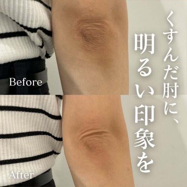 No.22907の症例写真ピンクインティメイト ５回