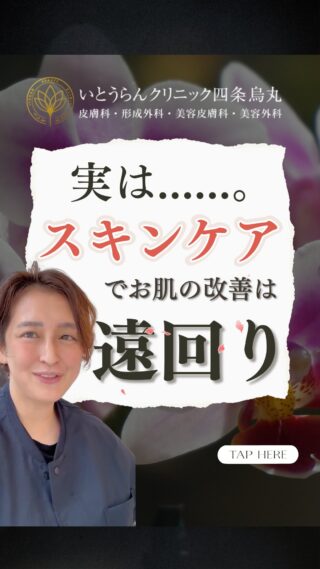 いとうらんクリニック四条烏丸です。(＠ranclinic.kyoto)お肌のお悩み解決したい方に！スキンケアにお金をかけてばかりいると遠回りかも！？医療美容をすると、トータルで費用がかからない可能性があります✨お肌のお悩み、ご相談は是非いとうらんクリニックまで皆様のご来院心よりお待ちしております🥰＊＊＊＊＊＊＊＊＊＊＊＊＊＊＊＊＊＊いとうらんクリニック四条烏丸(京都府京都市中京区手洗水町662 メディアジョイITビル 5F)営業時間 10:30〜19:00休診日 月曜日＊＊＊＊＊＊＊＊＊＊＊＊＊＊＊＊＊＊#美容外科 #美容皮膚科 #皮膚科#医療脱毛 #美容医療 #エイジングケア #若返り #肌質改善 #肌荒れ #女医 #いとうらんクリニック#いとうらんクリニック四条烏丸 #京都 #四条 #烏丸 #婦人科形成